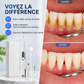 Détartreur Dentaire Ultrasonique – Anti-Tartre & Plaque, 5 Modes, Étanche IPX6